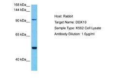 DDX10 Antibody, Novus Biologicals 100 &mu;L | Buy Online | Novus Biologicals | Fisher Scientific